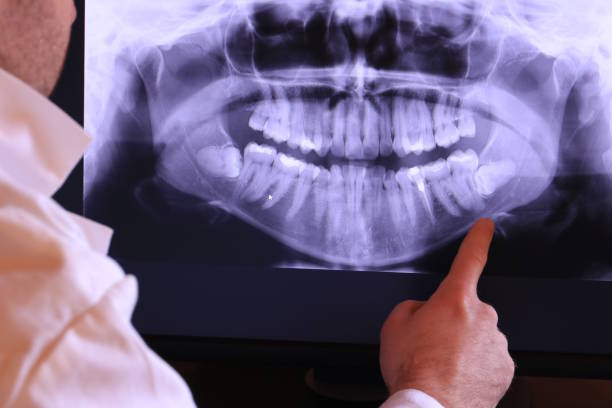 Best Pediatric Emergency Dentist in Pompton Lakes, NJ